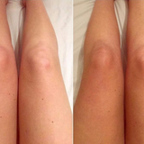 Isle of Paradise Hyglo Face Serum by green-goose, 30ml; side-by-side forearms showing before-and-after skin tone